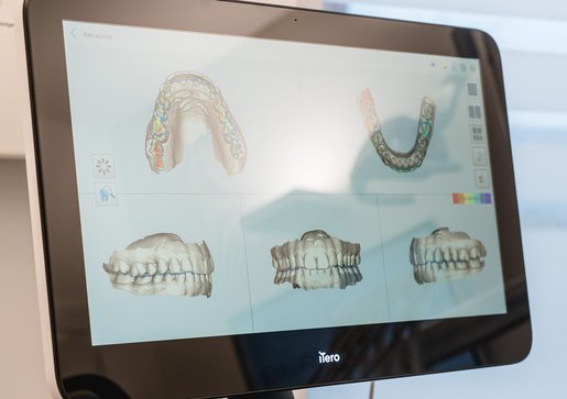 Ein Bildschirm in einer Zahnarztpraxis zeigt 3D-Modelle von Zahnreihen und Kieferscans.